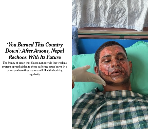New York Times Article: A man with severe facial burns lies in a hospital bed while a medical worker examines him. The headline beside the image discusses arson, protests, and the impact of burns in Nepal, highlighting the urgent need for reconstructive surgery. This powerful scene could serve as a poignant moment in a documentary film exploring resilience and recovery in Nepal.