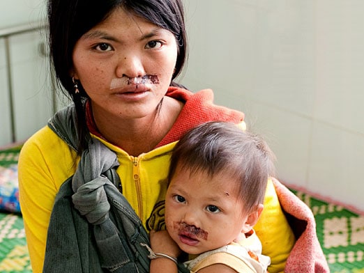 Helping-Mother-and-Child-Hoa-Hoai1