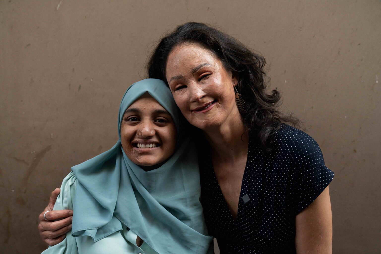 Two Acid Attack Survivors Meet for the First Time