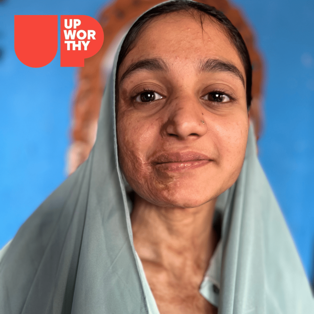 A woman wearing a light blue headscarf, an acid attack survivor, smiles gently in front of a blue background. The Upworthy logo is in the top left corner.