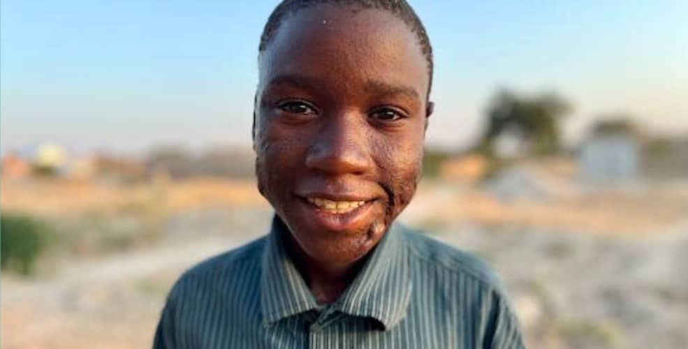 A smiling boy wearing a green striped shirt stands outdoors in a sunlit, blurry landscape with dry grass and distant trees—reminding us how lives can be transformed when you donate to ReSurge.