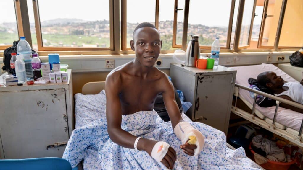 Augustine Tumwesigye, 25, recovering at Kiruddu National Referral Hospital in Uganda after thumb reconstruction surgery by ReSurge International