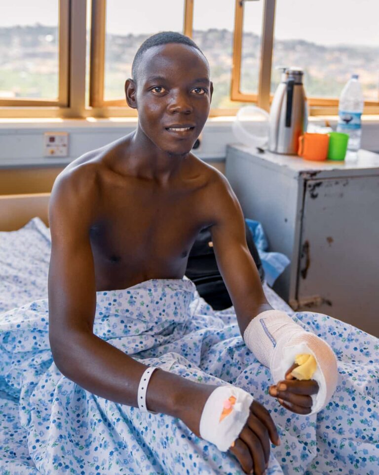 A young man sits on a hospital bed with a bandaged hand, having lost his thumb. Wearing a hospital gown, he is indoors near a window, with medical supplies and cups on a cabinet beside him after thumb reconstruction by ReSurge.