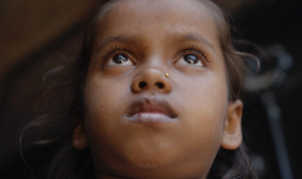 A young girl with brown skin and dark hair looks upward, her expression calm and thoughtful—a quiet strength that reflects the hope often inspired by access to reconstructive surgical care. The background is blurred, drawing focus to her face and bright eyes.