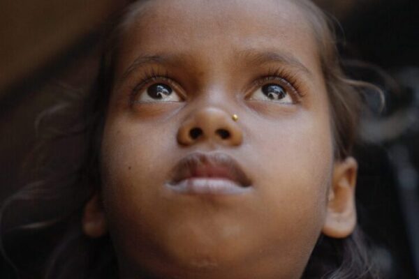A young girl with brown skin and dark hair looks upward, her expression calm and thoughtful—a quiet strength that reflects the hope often inspired by access to reconstructive surgical care. The background is blurred, drawing focus to her face and bright eyes.