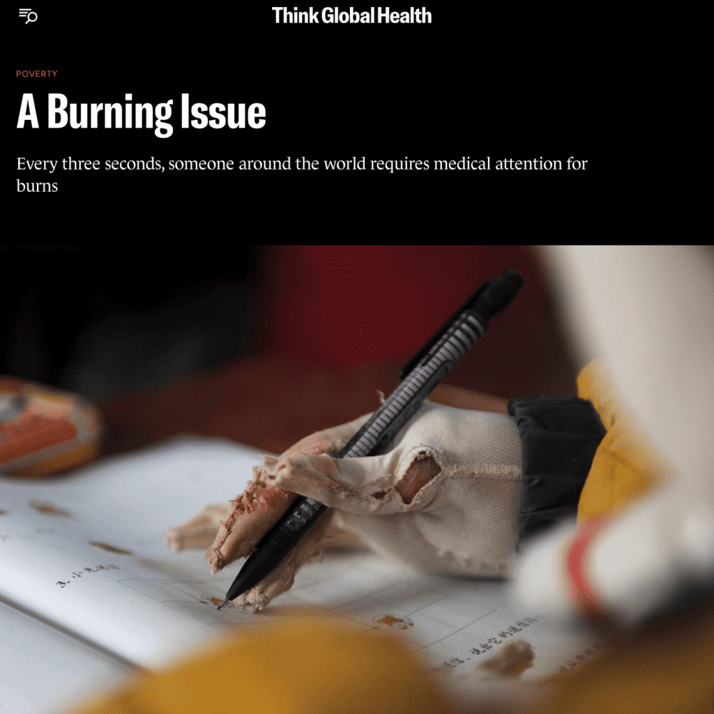 A person with burn injuries on their bandaged hand writes in a notebook with a pen. Text above reads, “A Burning Issue: Every three seconds, someone around the world requires medical attention for burns.” Access to Reconstructive Surgical Care can be vital in helping burn survivors recover and regain function.