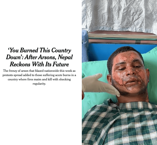 New York Times Article: A man with severe facial burns lies in a hospital bed while a medical worker examines him. The headline beside the image discusses arson, protests, and the impact of burns in Nepal, highlighting the urgent need for reconstructive surgery. This powerful scene could serve as a poignant moment in a documentary film exploring resilience and recovery in Nepal.